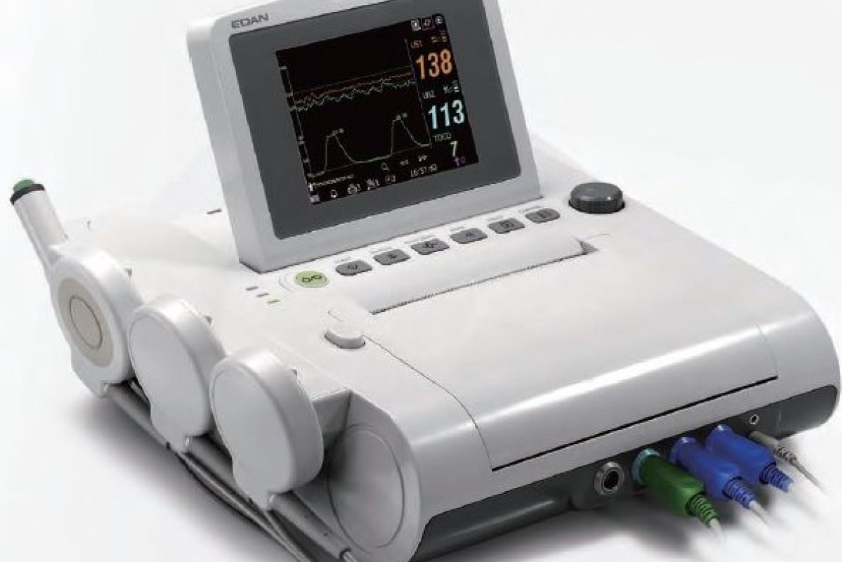 Monitor fetal