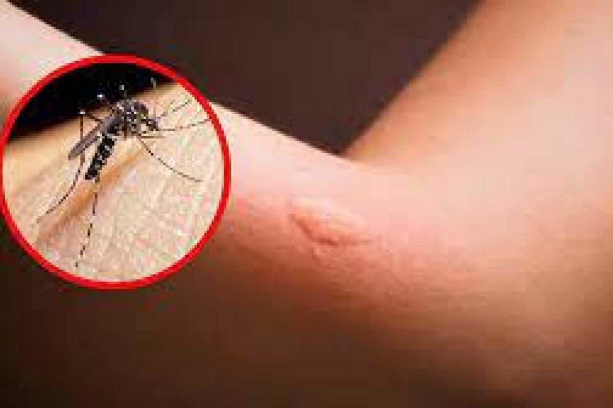 Dengue Dengue